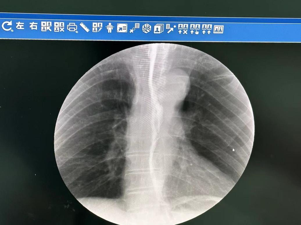 噪音1.png 噪音1.png