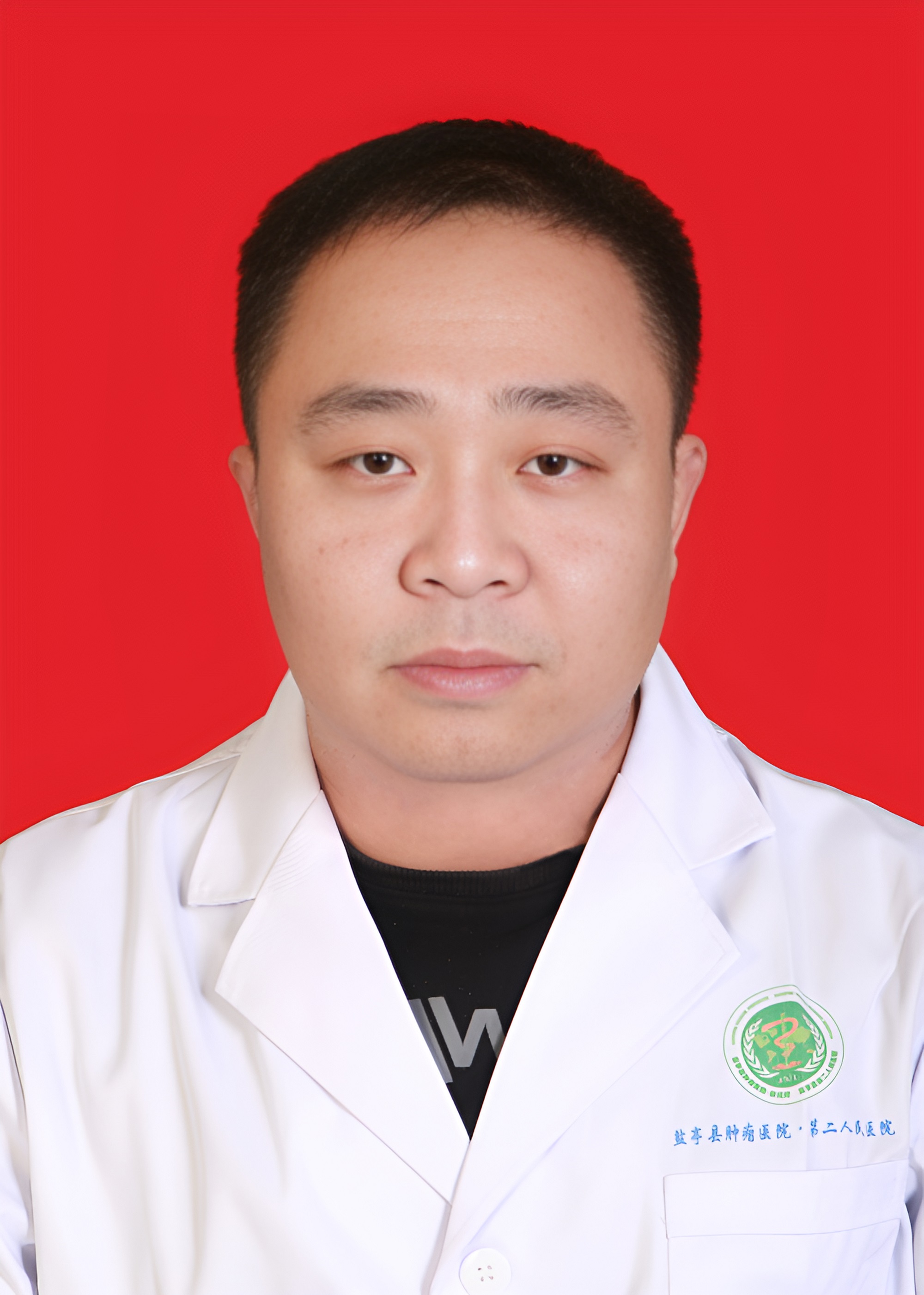 张戈